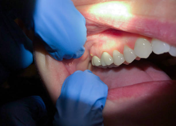 Best Cracked Tooth Emergency Dentist  in Oakton, VA